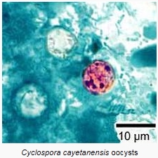 Cyclospora cayetanensis:http://en.wikipedia.org/wiki/Cyclospora_cayetanensis