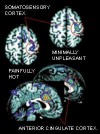 PET scan of brain